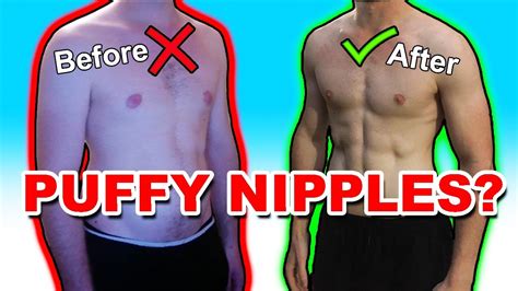 how to get rid of puffy nipples in women|The Complete Guide to Puffy Nipples